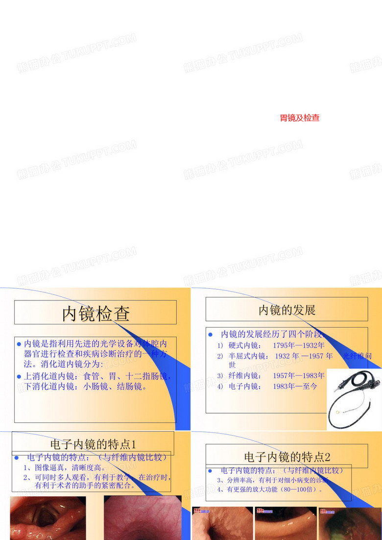胃镜及检查