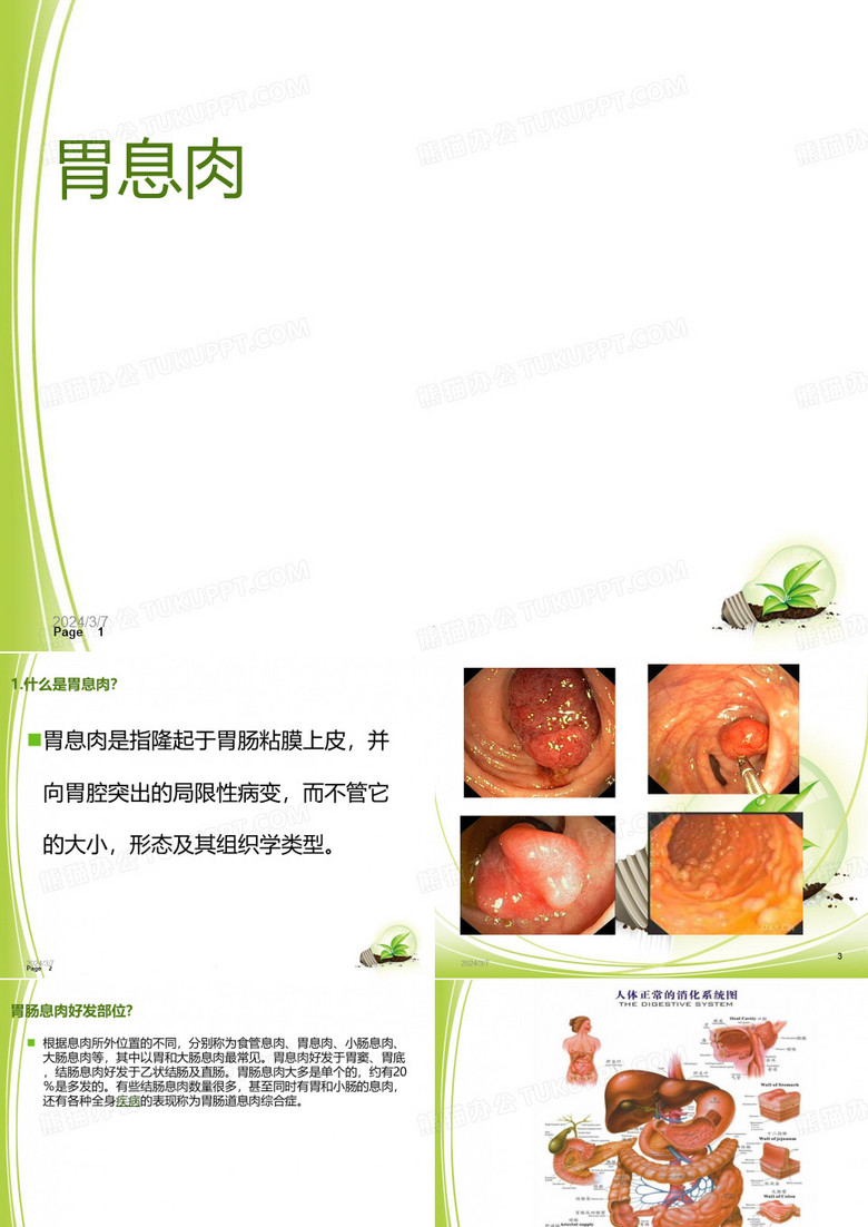 胃息肉的护理PPT课件