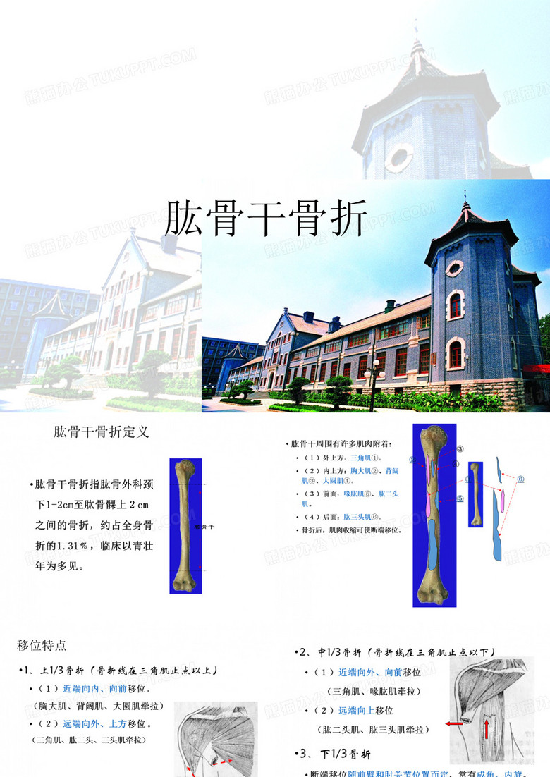 肱骨干骨折