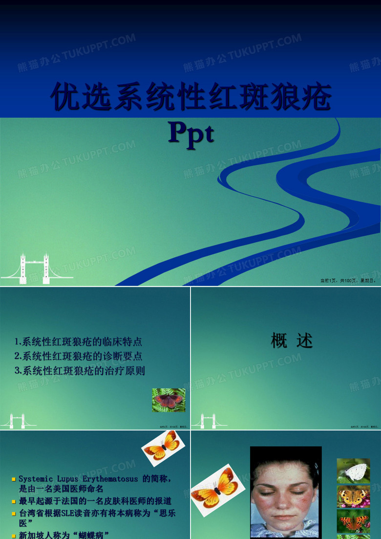 系统性红斑狼疮
