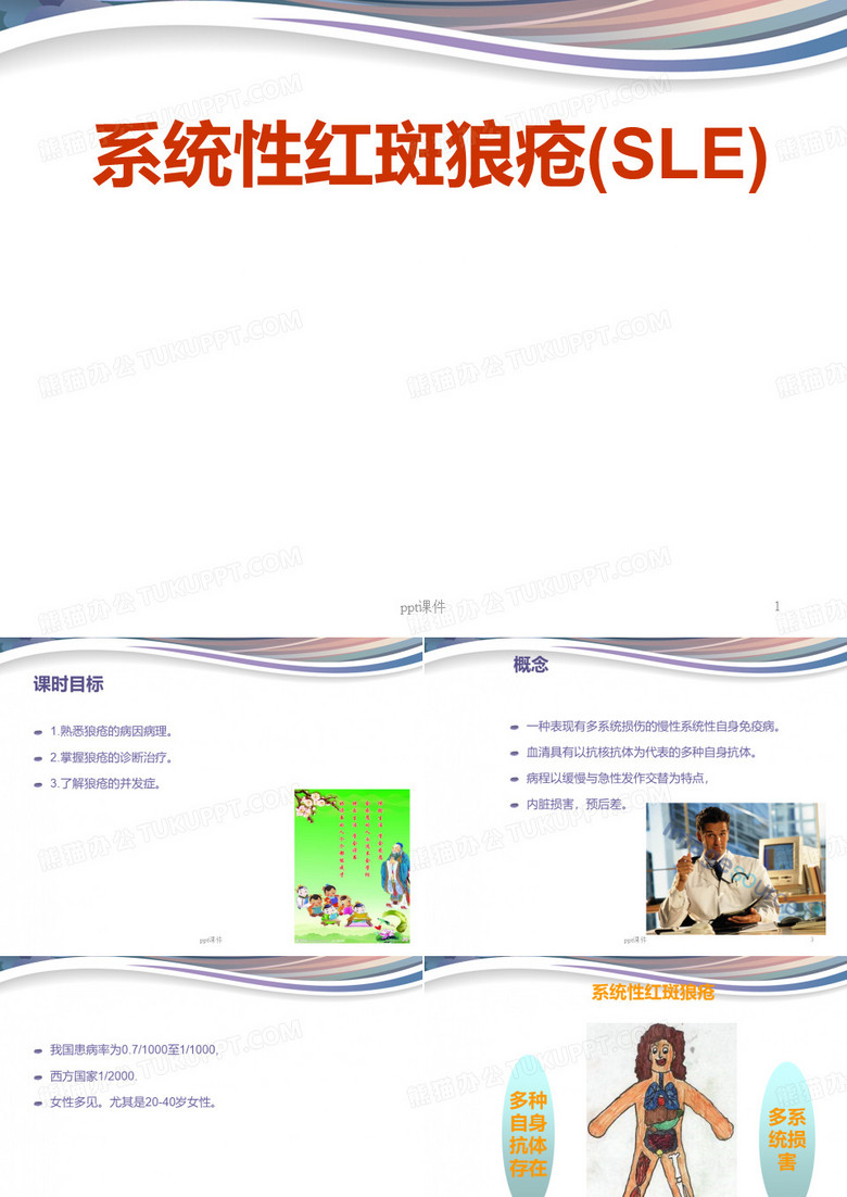 系统性红斑狼疮