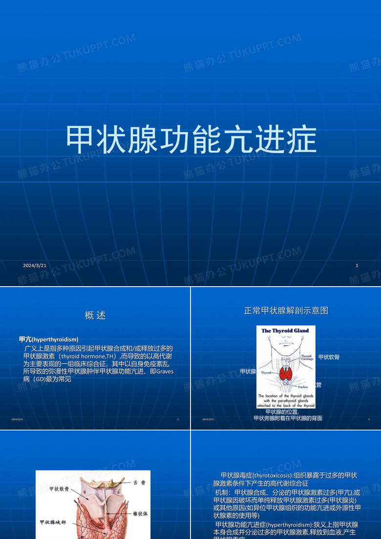 甲状腺功能亢进症