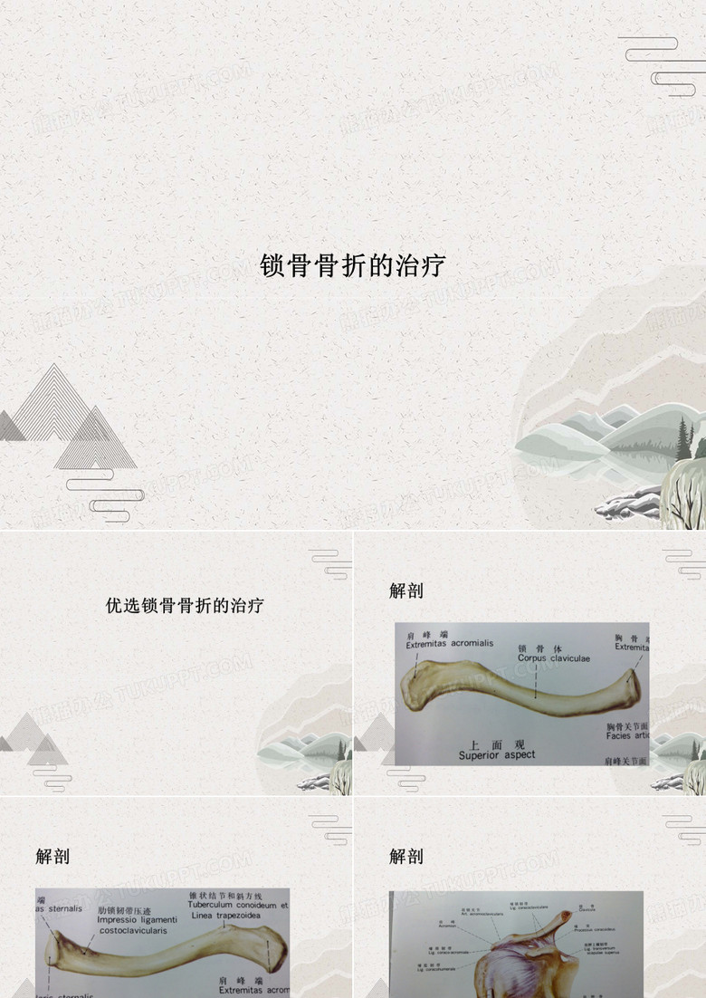 锁骨骨折的治疗
