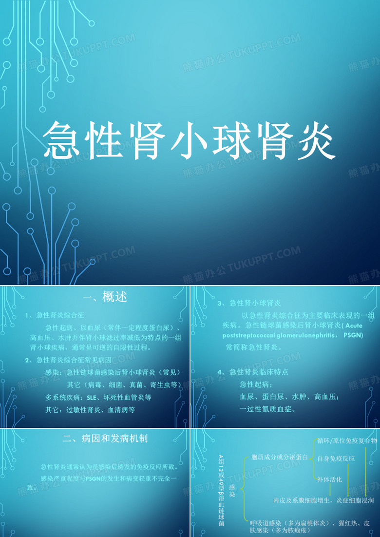 急性肾小球肾炎