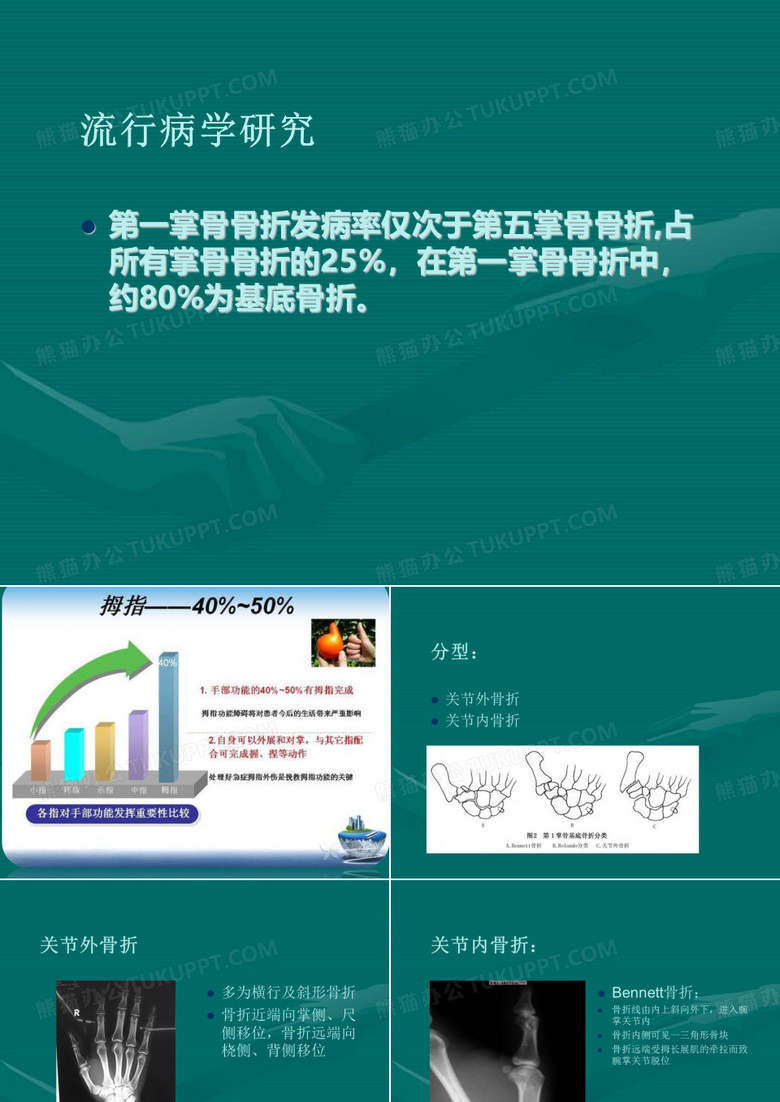 第一掌骨基底骨折