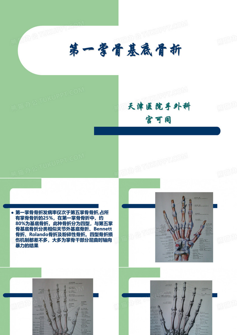 第一掌骨基底骨折