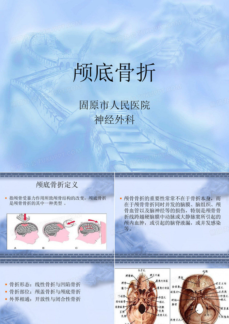 颅底骨折