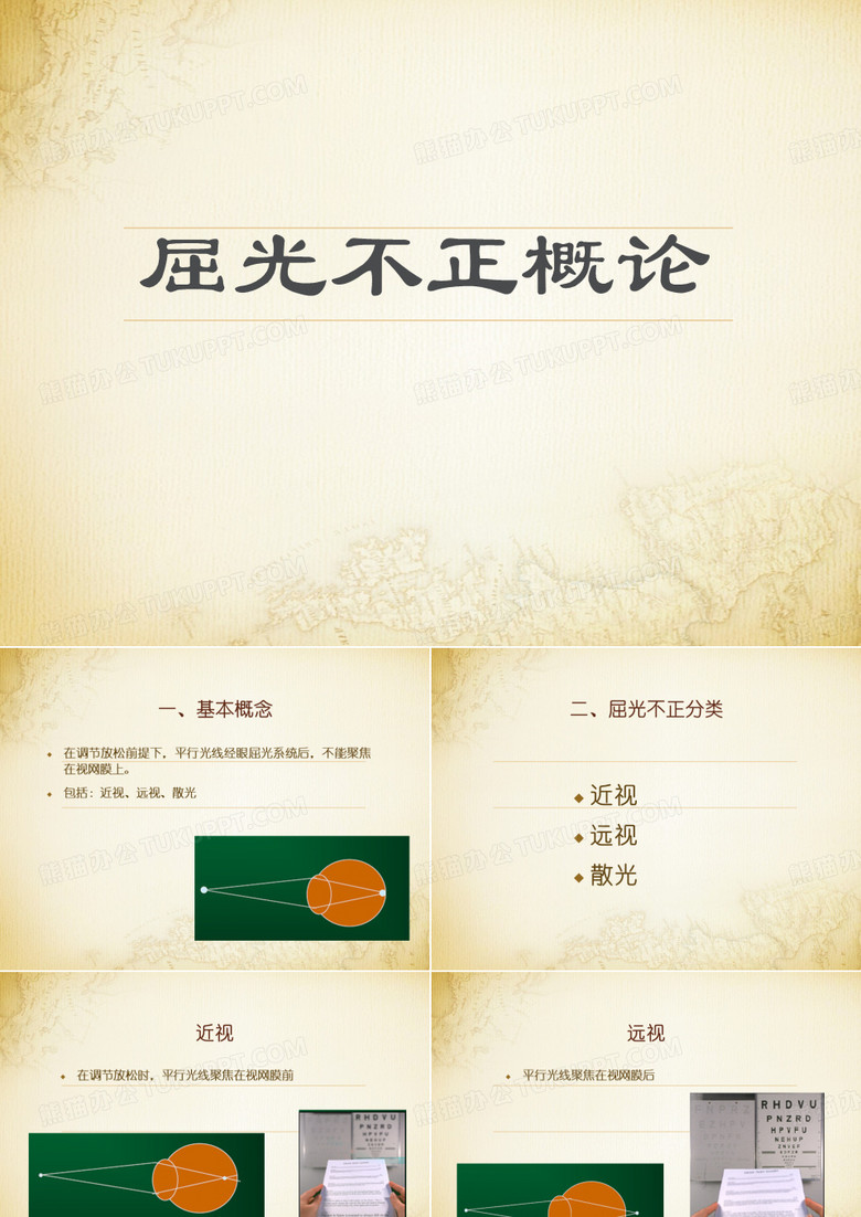 屈光不正概论