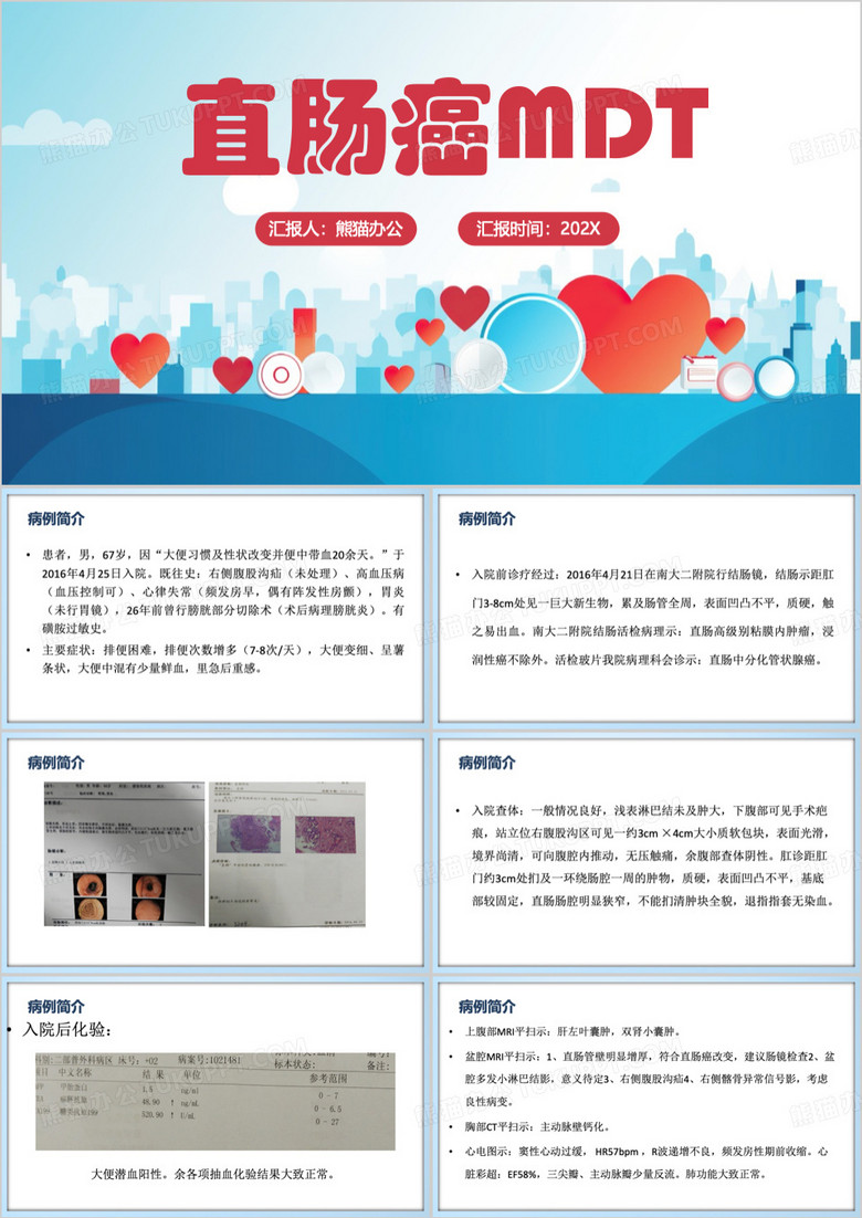 蓝色简约风直肠癌MDT医学介绍PPT模板