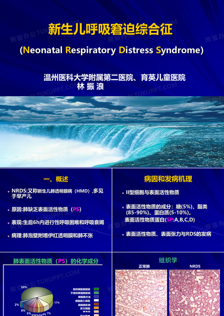 新生儿呼吸窘迫综合征