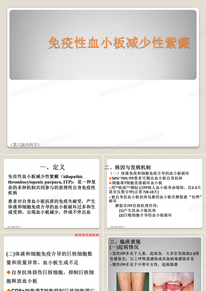 免疫性血小板减少性紫癜