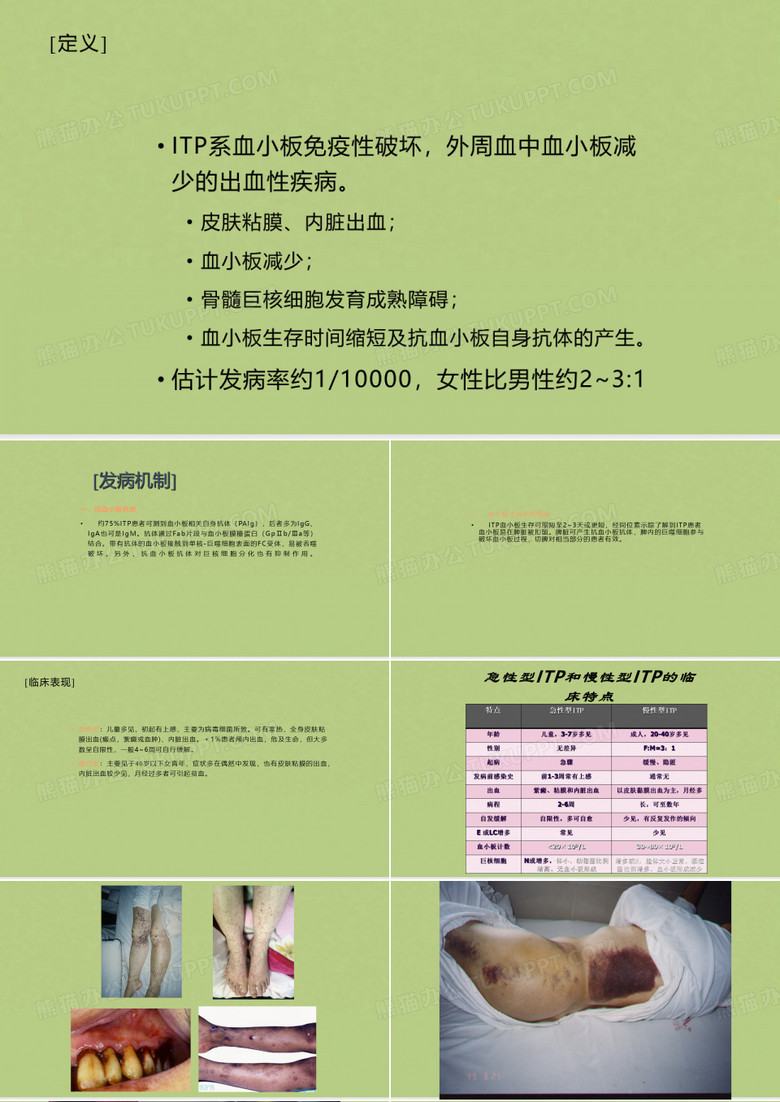 特发性血小板减少性紫癜