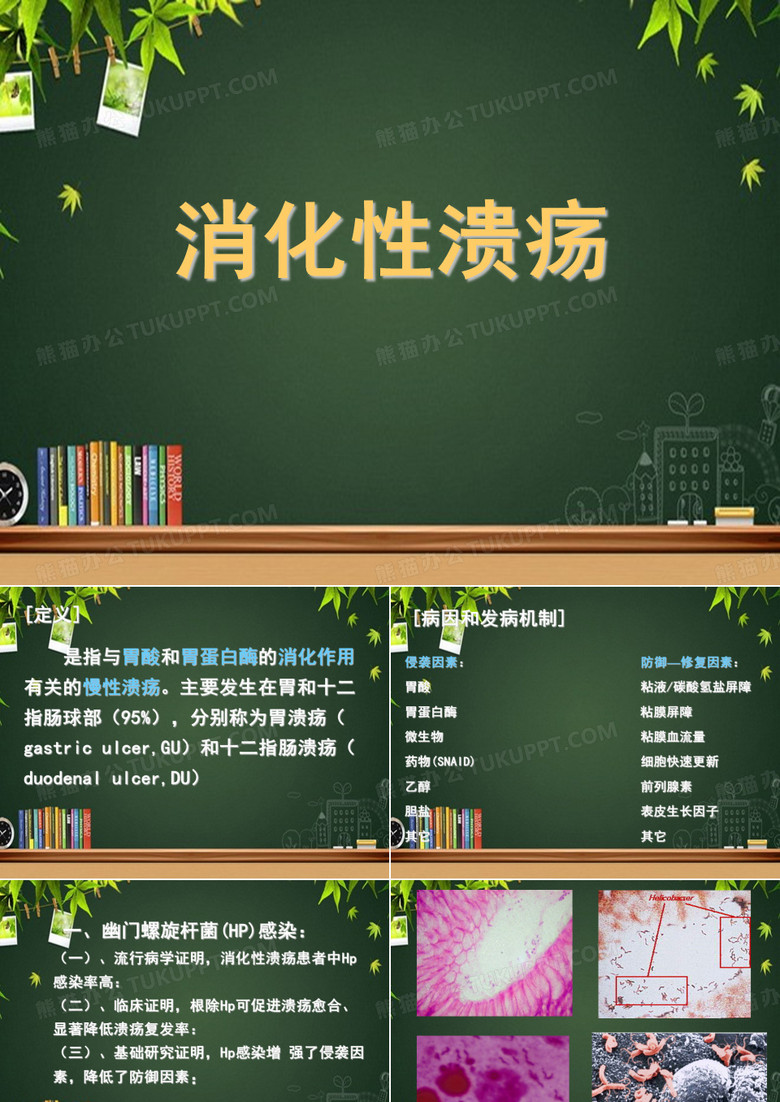 消化性溃疡 PPT-消化性溃疡( )