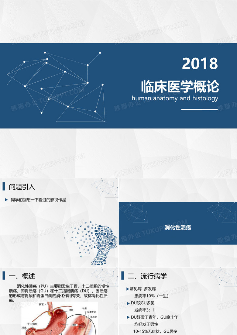 消化性溃疡