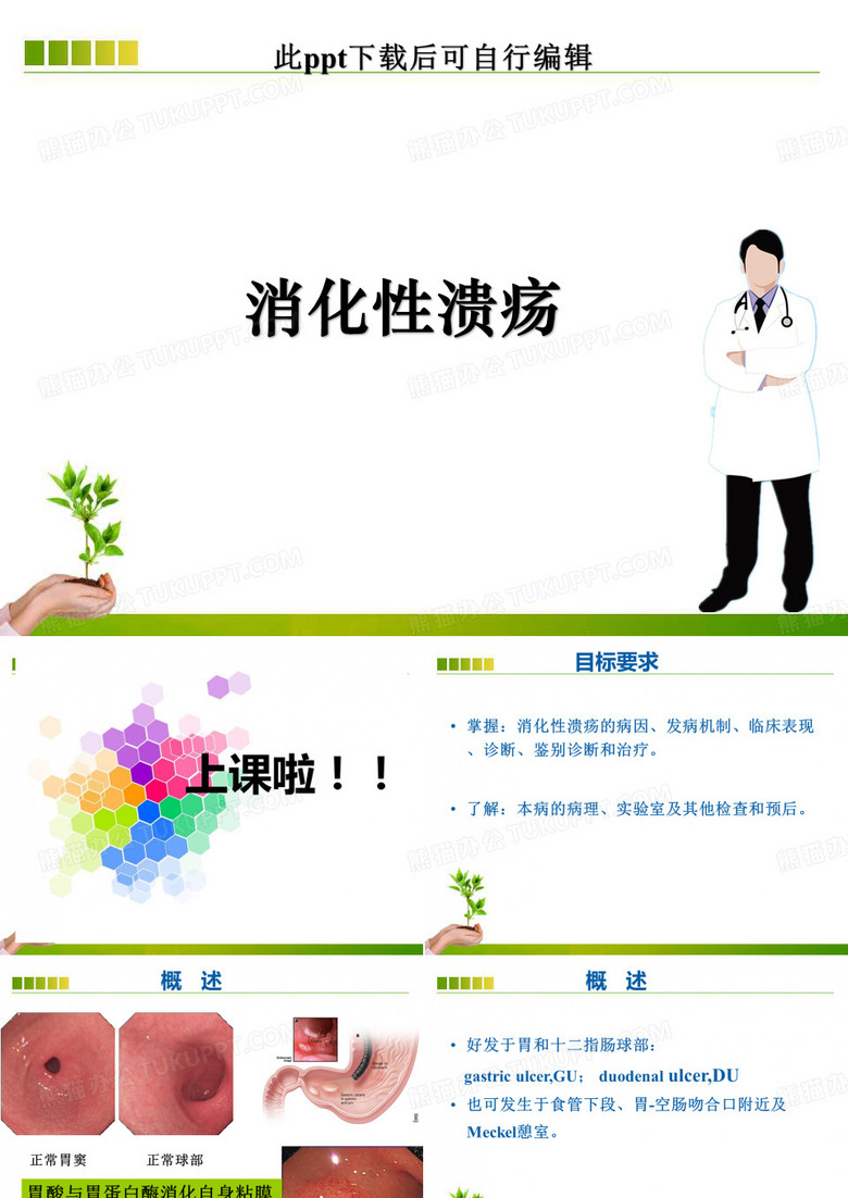消化性溃疡ppt