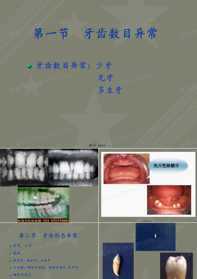 口腔组织病理学——口腔病理学