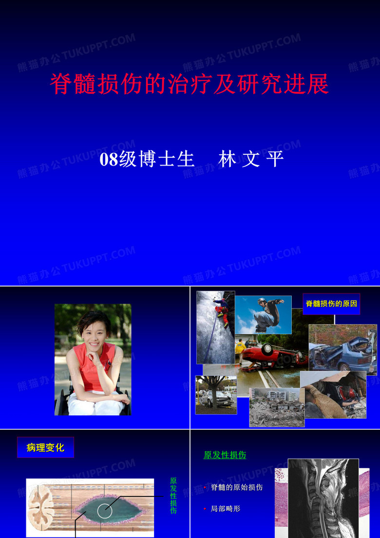 脊髓损伤