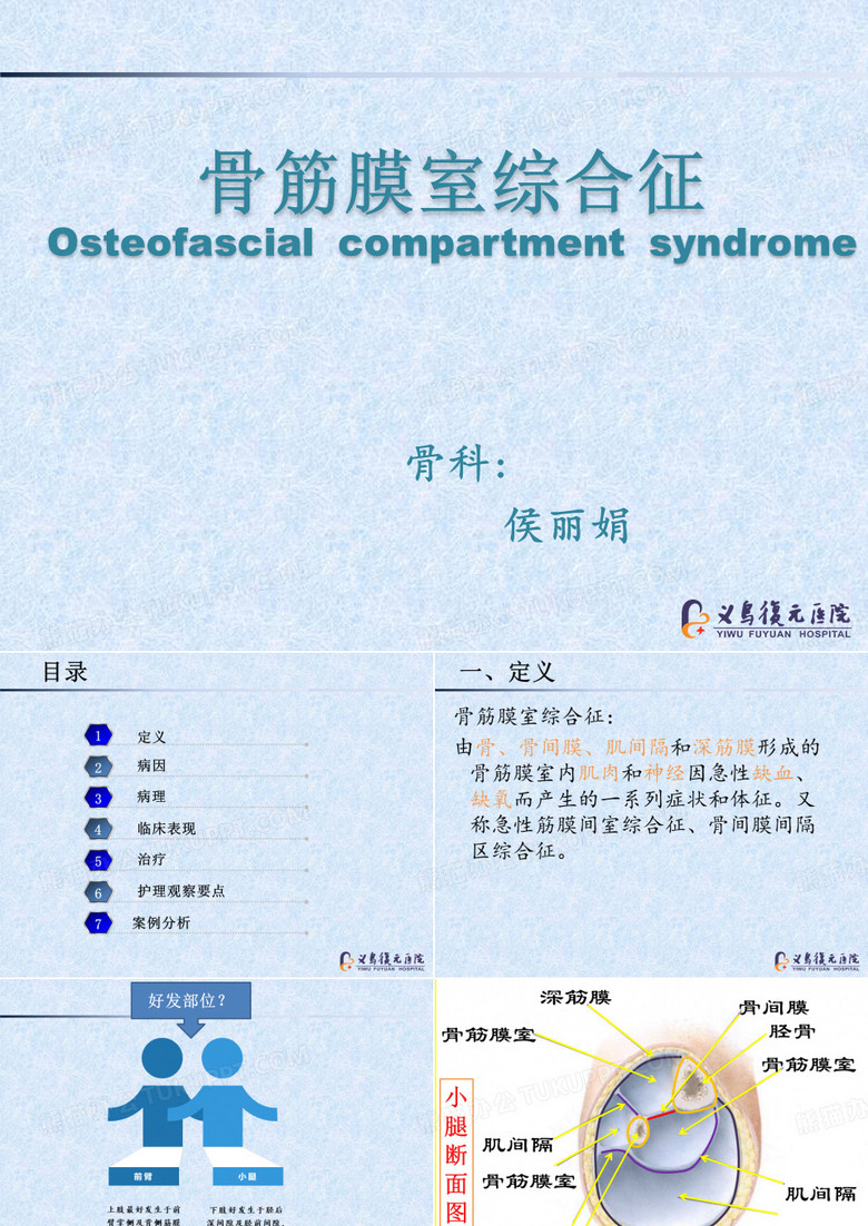 骨筋膜室综合征