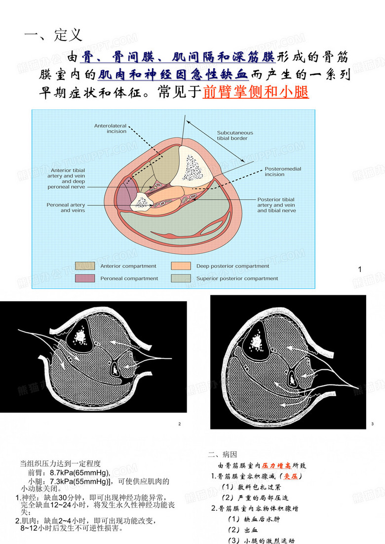 骨筋膜室综合征