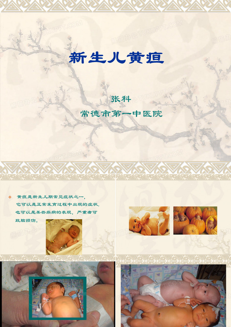 新生儿黄疸课件
