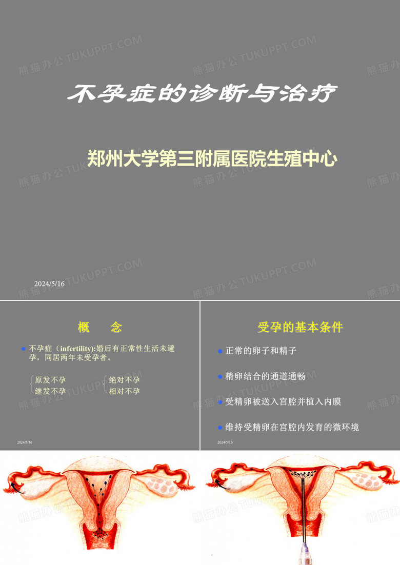 不孕症 课件