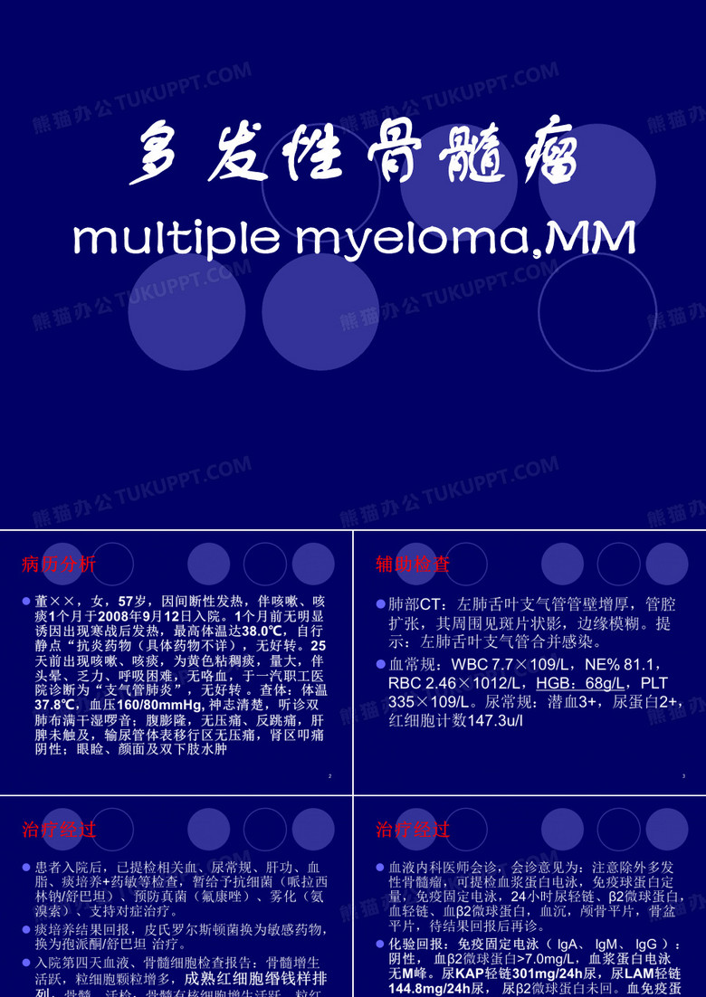 多发性骨髓瘤