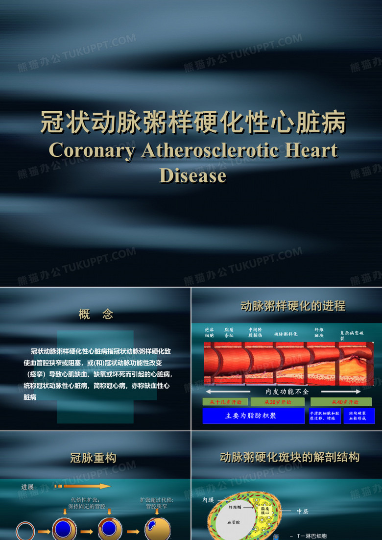 冠状动脉粥样硬化性心脏病