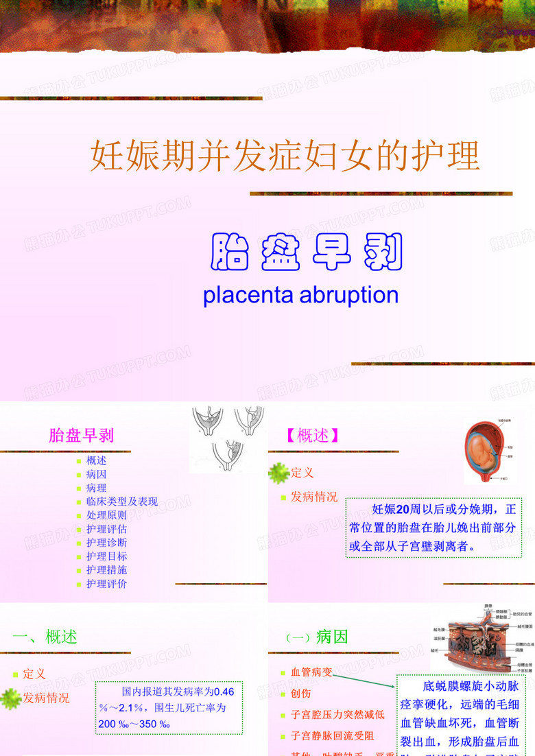 胎盘早剥