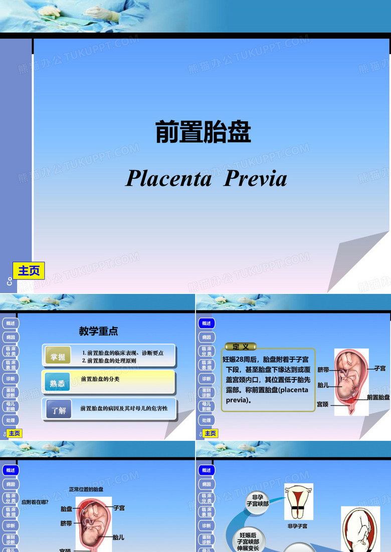 前置胎盘、胎盘早剥