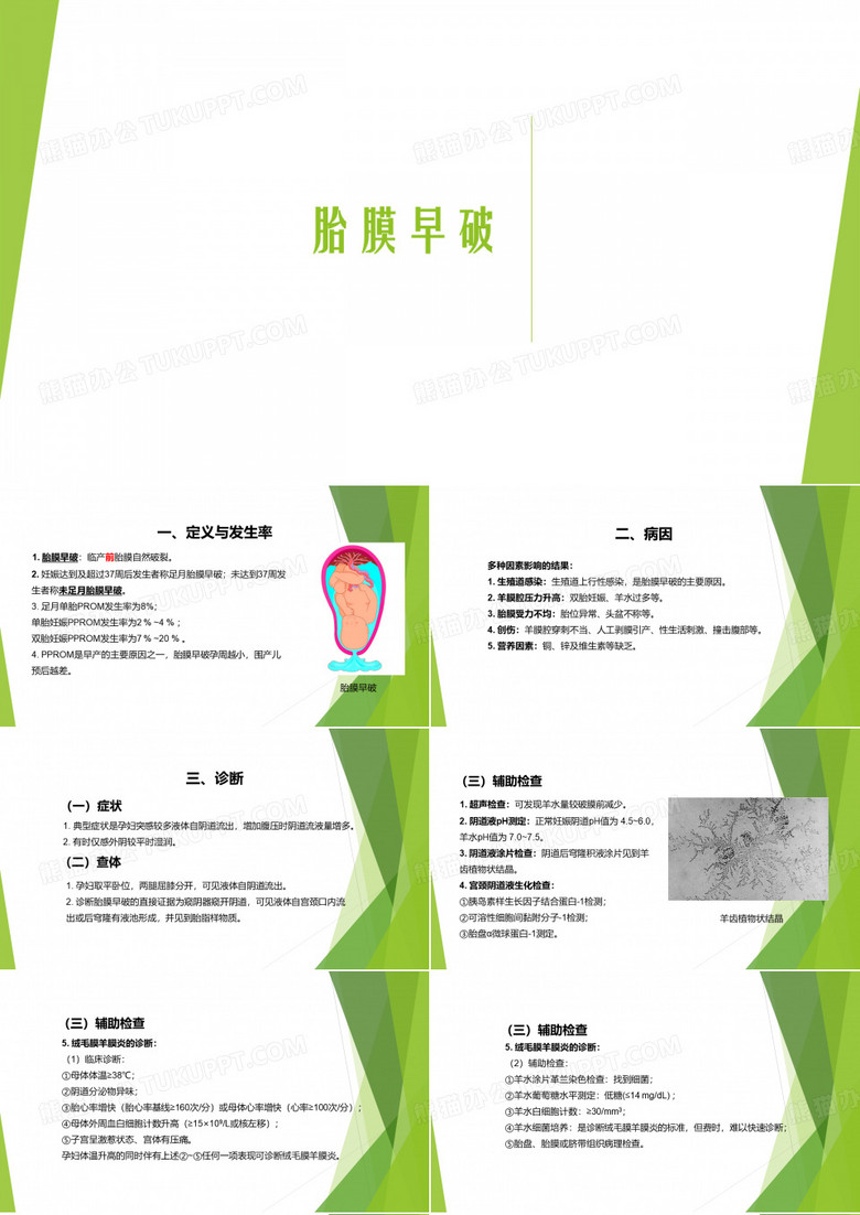 胎膜早破 