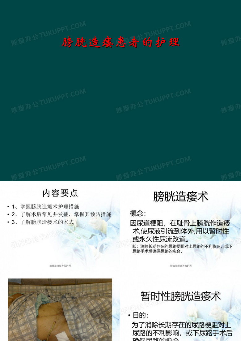 膀胱造瘘患者的护理