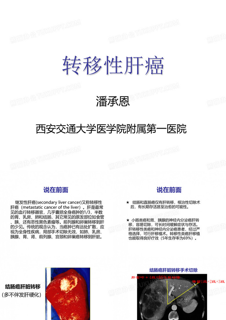 转移性肝癌