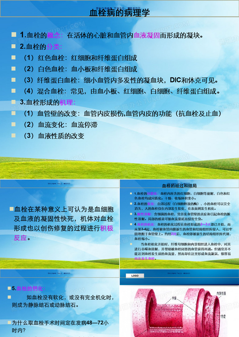 下肢深静脉血栓