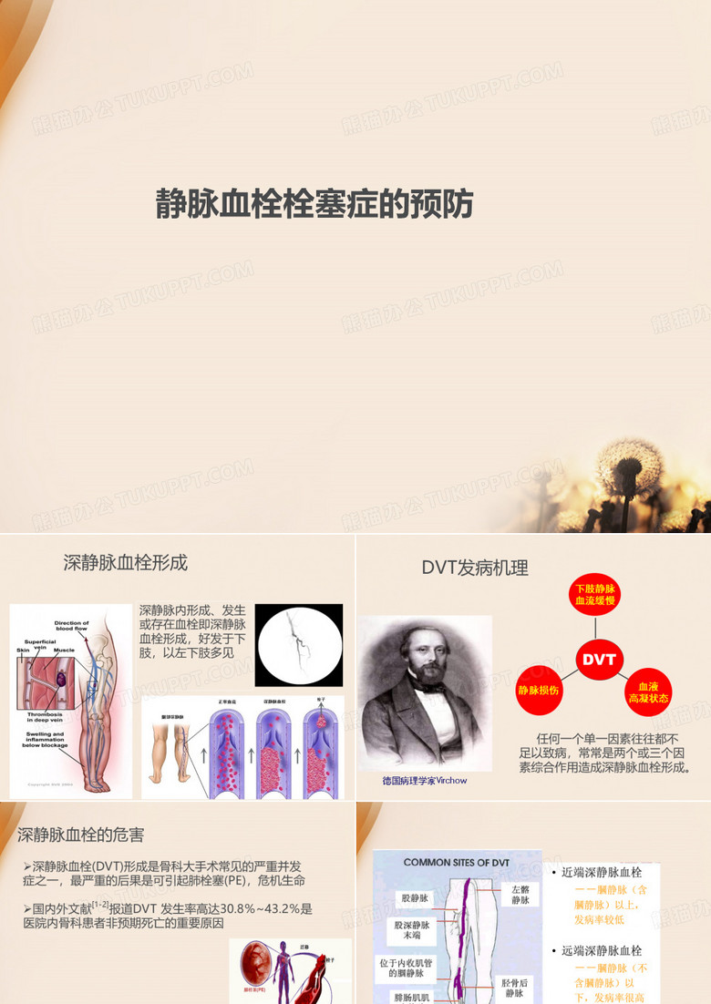 下肢深静脉血栓