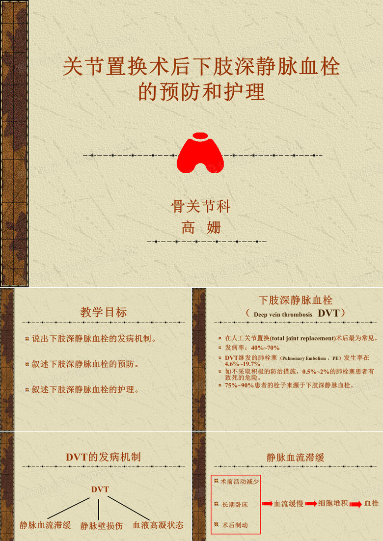 下肢深静脉血栓