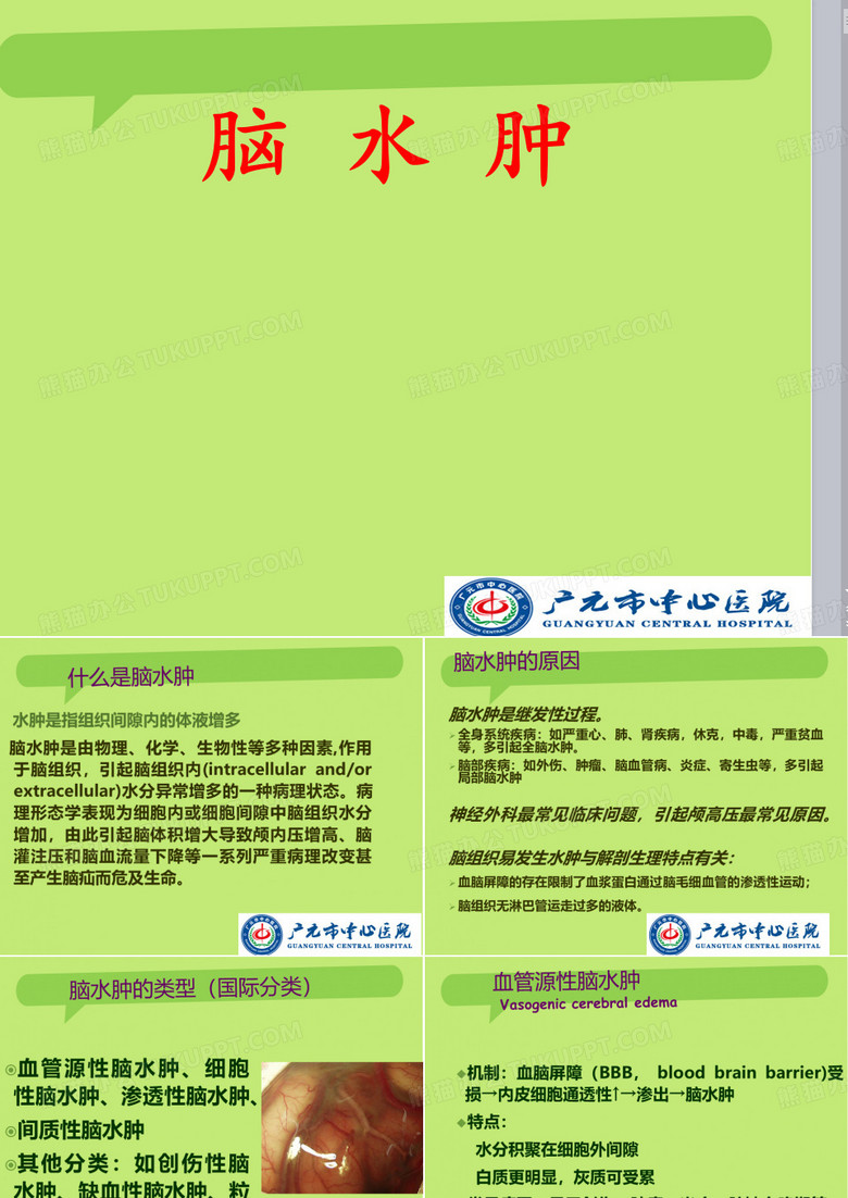 脑水肿