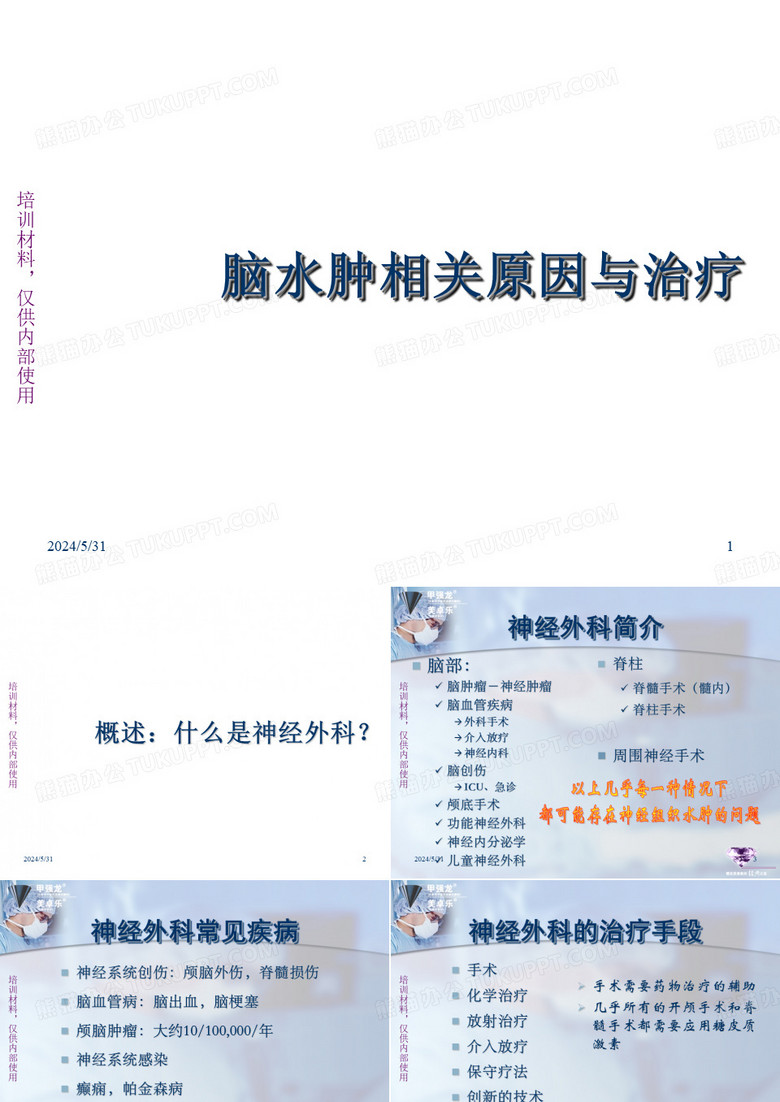 神经外科-脑水肿