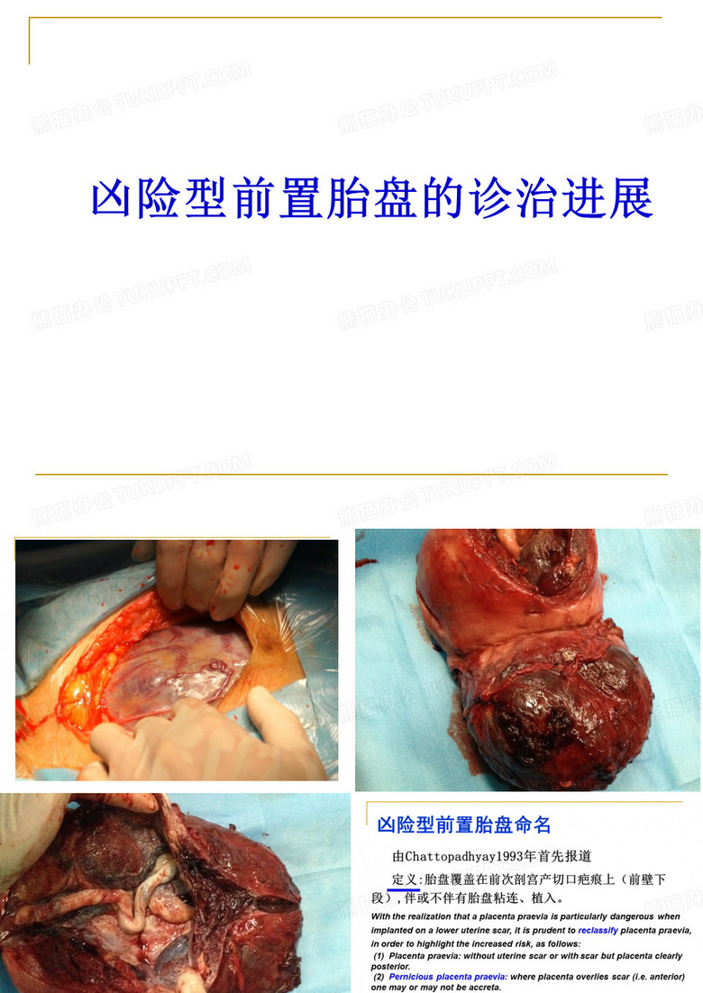 凶险性前置胎盘诊治