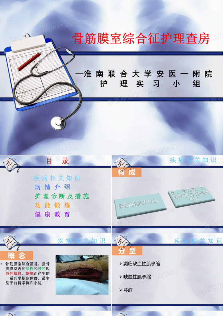 骨筋膜室综合症护理查房