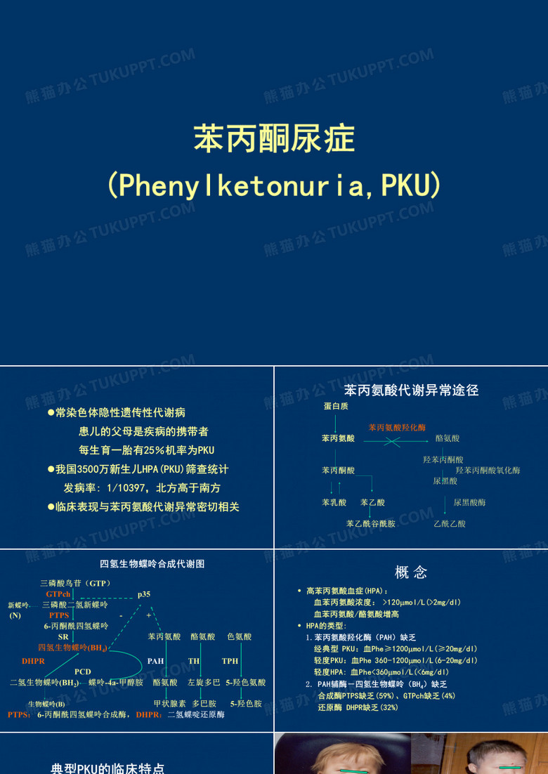 苯丙酮尿症