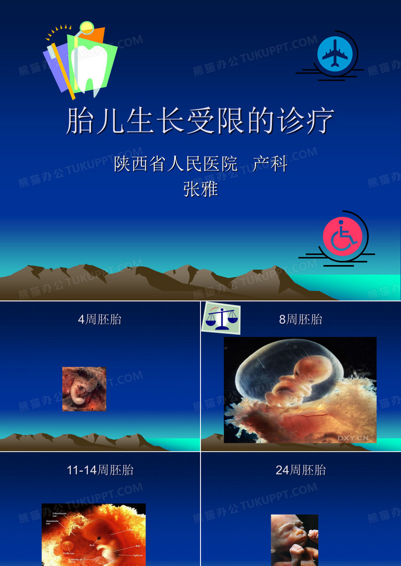 胎儿生长受限的诊疗