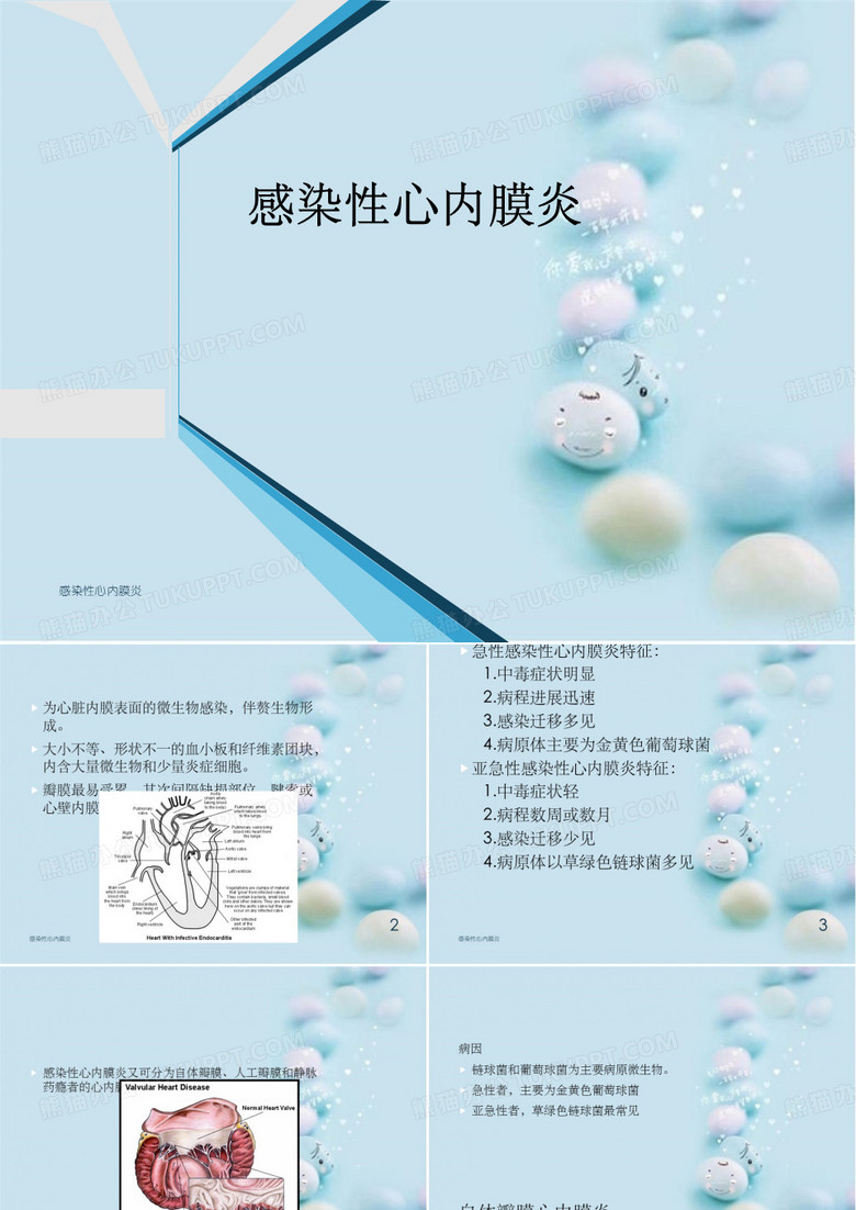 感染性心内膜炎
