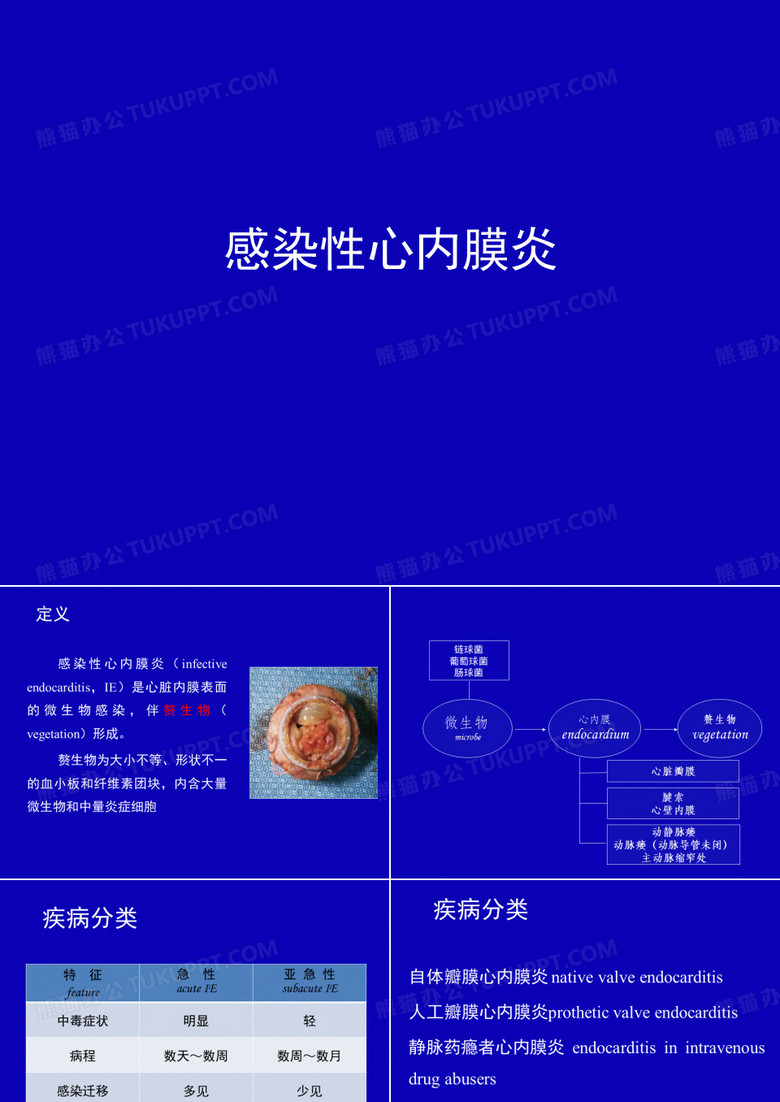 感染性心内膜炎