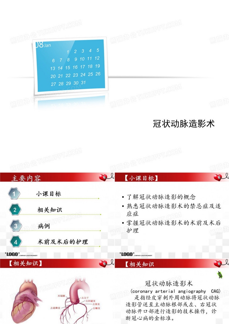 冠状动脉造影术
