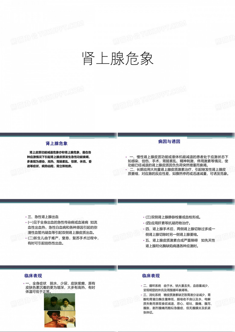 肾上腺危象