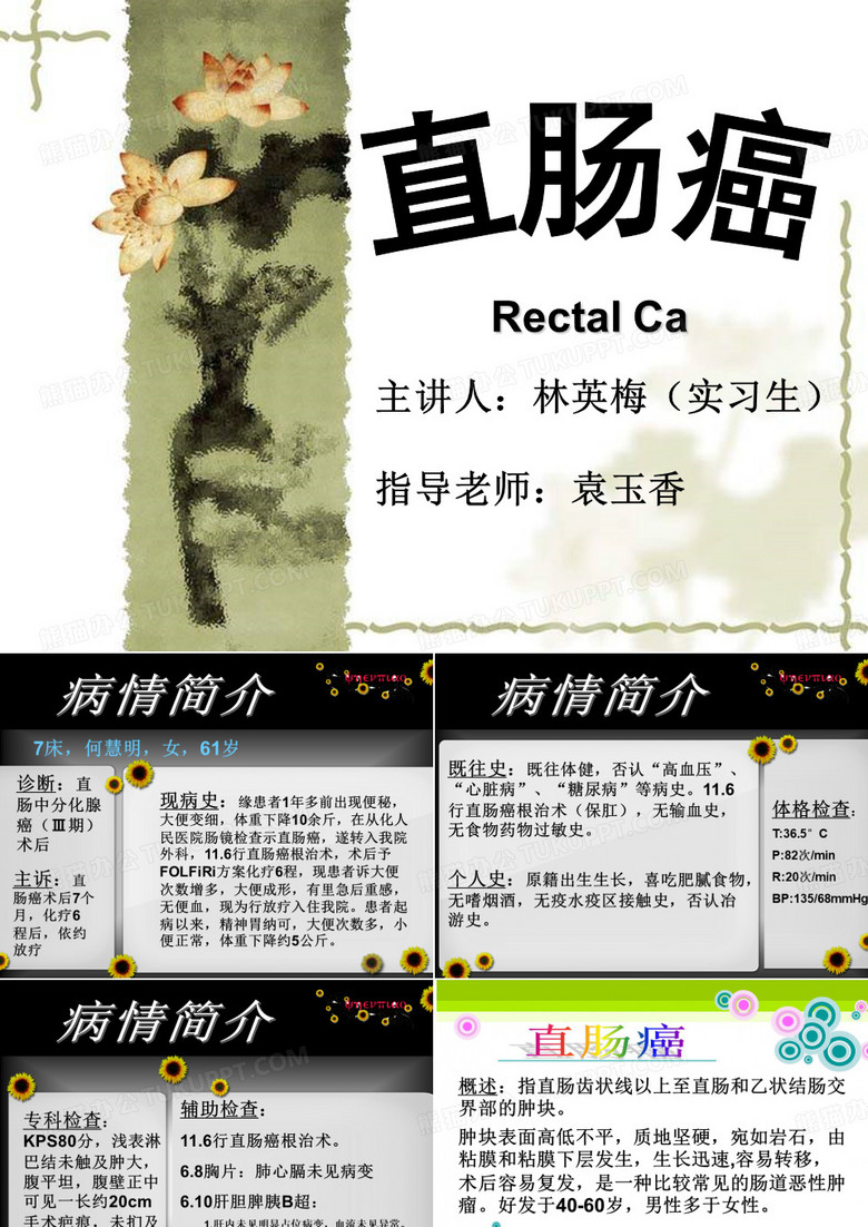 直肠癌