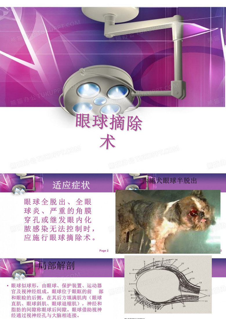 眼球摘除