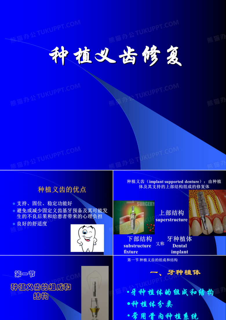 种植义齿