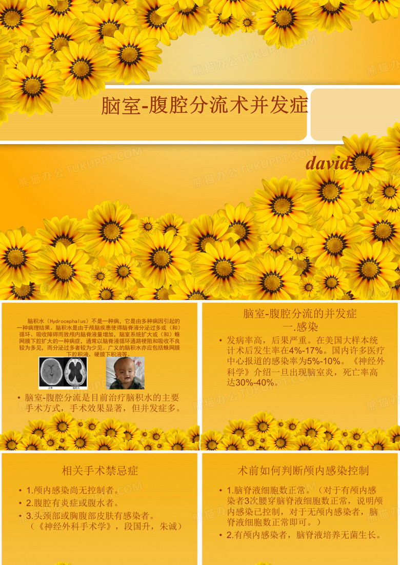 脑室-腹腔分流术并发症