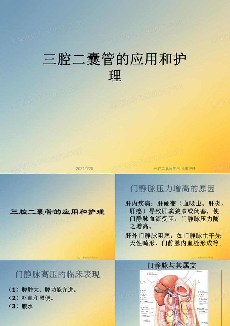 三腔二囊管的应用和护理